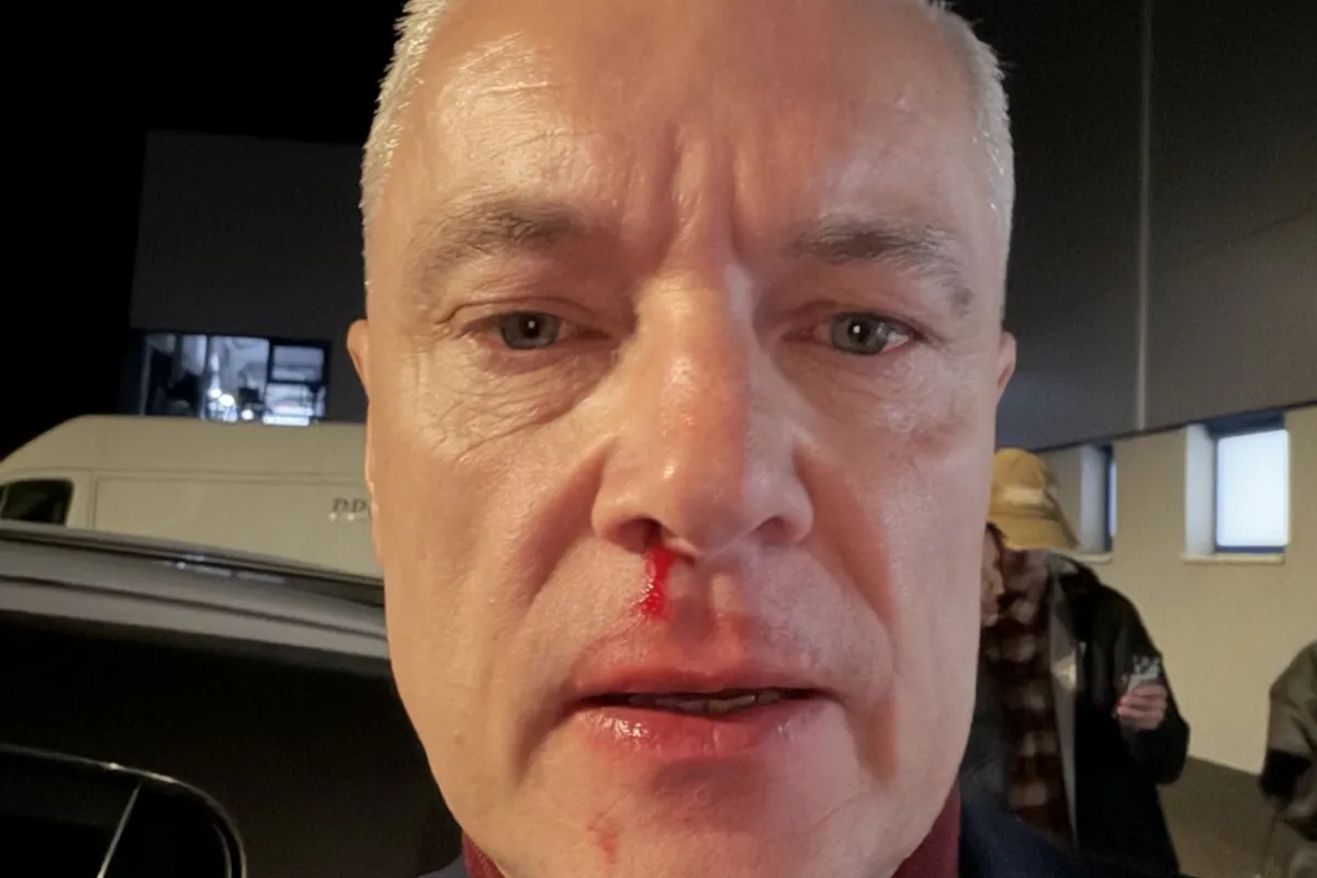 Polícia zadržala útočníka, ktorý napadol Ferenčáka. Mal byť na kamerových záznamoch, poslanec utrpel otras mozgu