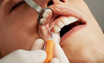 Lacné ošetrenie zubov vám v Bratislave ponúknu aj študenti stomatológie. Ušetríte s nimi desiatky eur