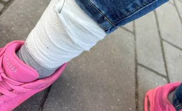 Pes pohrýzol ženu na ulici v Rači, keď to chcela riešiť, majiteľ sa pred ňou schoval v dome. Nereagoval ani na políciu