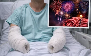 Silvestrová noc sa zmenila na tragédiu, mužovi u našich susedov zakázaný pyrotechnika odpálila obe ruky