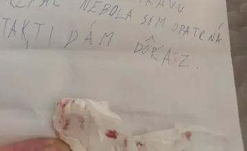 Zubári v Bratislave pobavili obyvateľov na odkaze dieťaťa. Neuveríte, aký dôkaz o stratenom zube poslalo zúbkovej víle