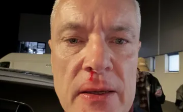 Polícia zadržala útočníka, ktorý napadol Ferenčáka. Mal byť na kamerových záznamoch, poslanec utrpel otras mozgu