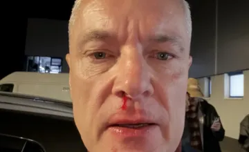 Primátor Kežmarku Ján Ferenčák po nočnom útoku vypovedal. Na políciu prišiel v doprovode právnika