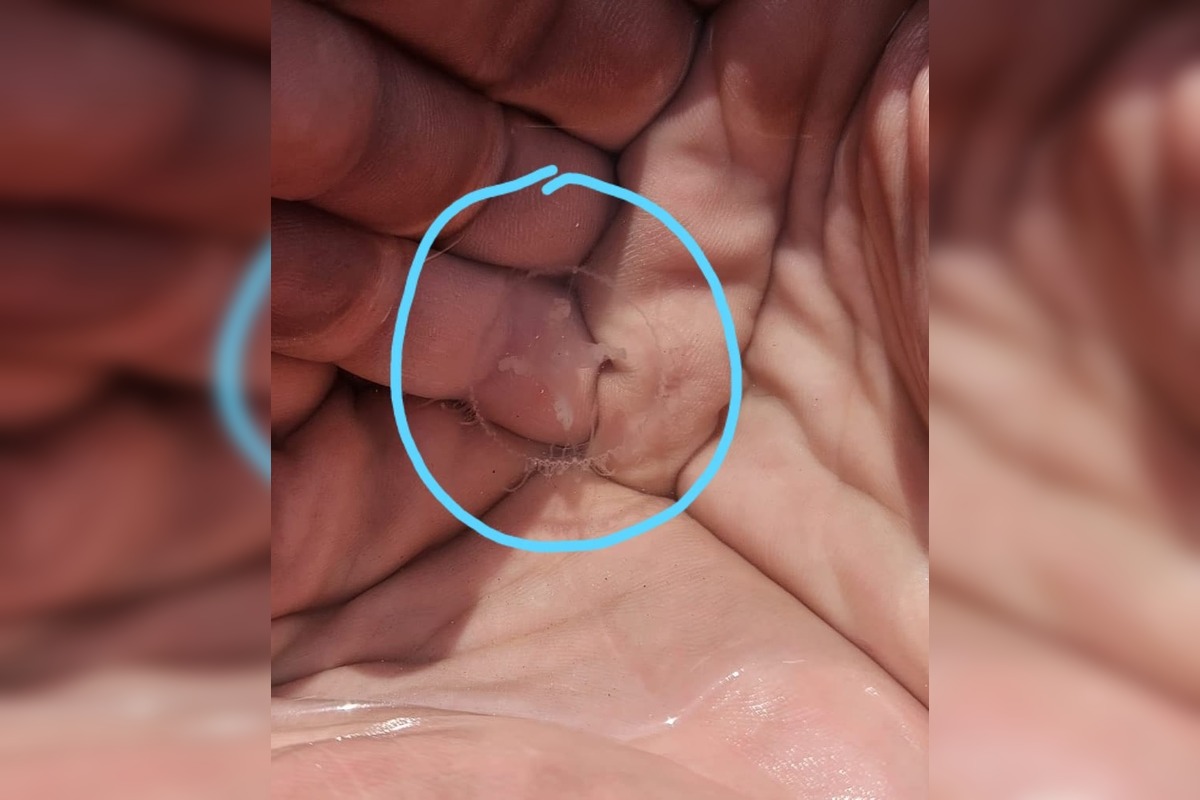 FOTO: Medúzky na Zlatých pieskoch a na Draždiaku, foto 5