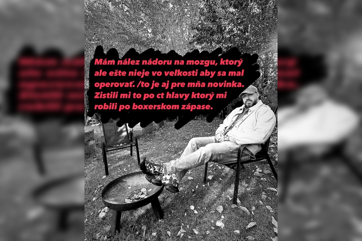 FOTO: Rapero Momo oznámil, že mu na mozgu našli nádor, foto 6