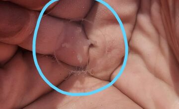 FOTO: Medúzky na Zlatých pieskoch a na Draždiaku