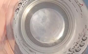 FOTO: Medúzky na Zlatých pieskoch a na Draždiaku