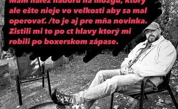 FOTO: Rapero Momo oznámil, že mu na mozgu našli nádor